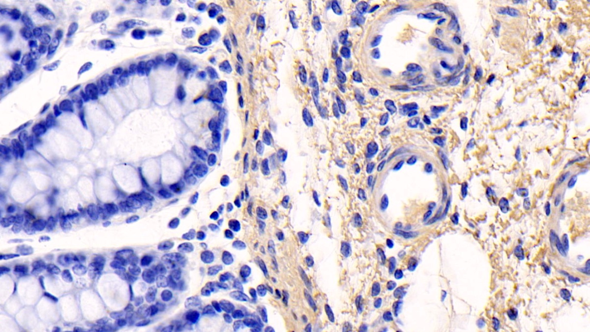 Monoclonal Antibody to Collagen Type I Alpha 1 (COL1a1)