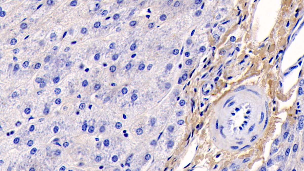 Monoclonal Antibody to Collagen Type I Alpha 1 (COL1a1)