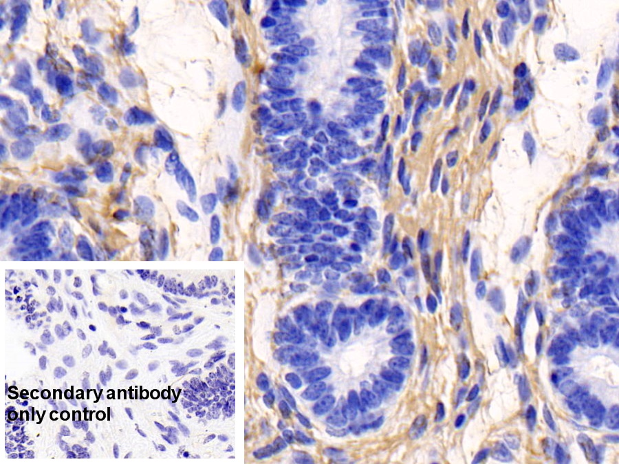 Monoclonal Antibody to Collagen Type I Alpha 1 (COL1a1)