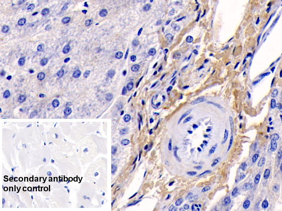 Monoclonal Antibody to Collagen Type I Alpha 1 (COL1a1)