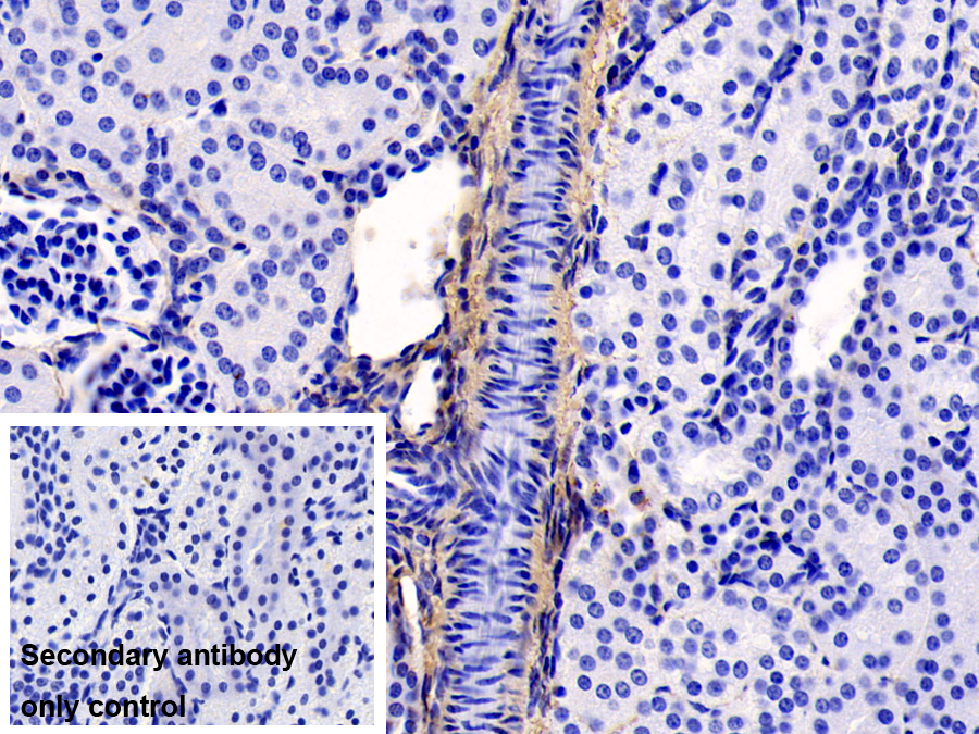 Monoclonal Antibody to Collagen Type I Alpha 1 (COL1a1)