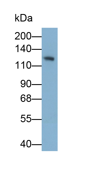 Monoclonal Antibody to Platelet/Endothelial Cell Adhesion Molecule (PECAM1)