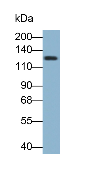 Monoclonal Antibody to Platelet/Endothelial Cell Adhesion Molecule (PECAM1)