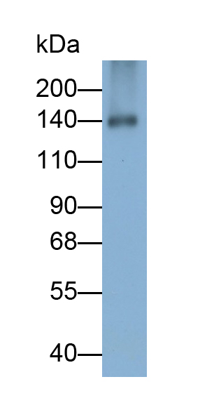 Monoclonal Antibody to Retinol Binding Protein 3, Interstitial (RBP3)