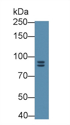 Monoclonal Antibody to Gelsolin (GSN)