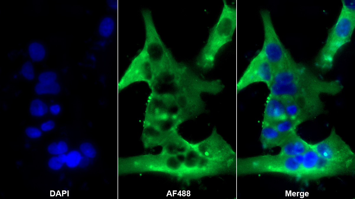 Monoclonal Antibody to Desmin (Des)