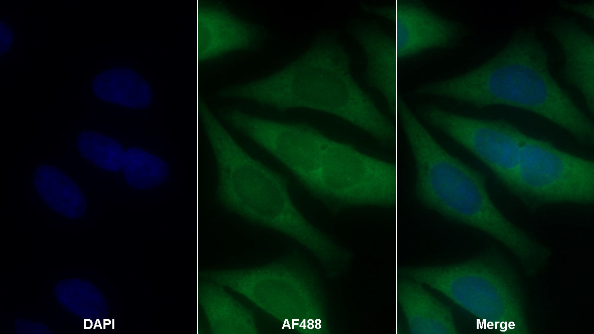 Monoclonal Antibody to Complement Component 3a (C3a)