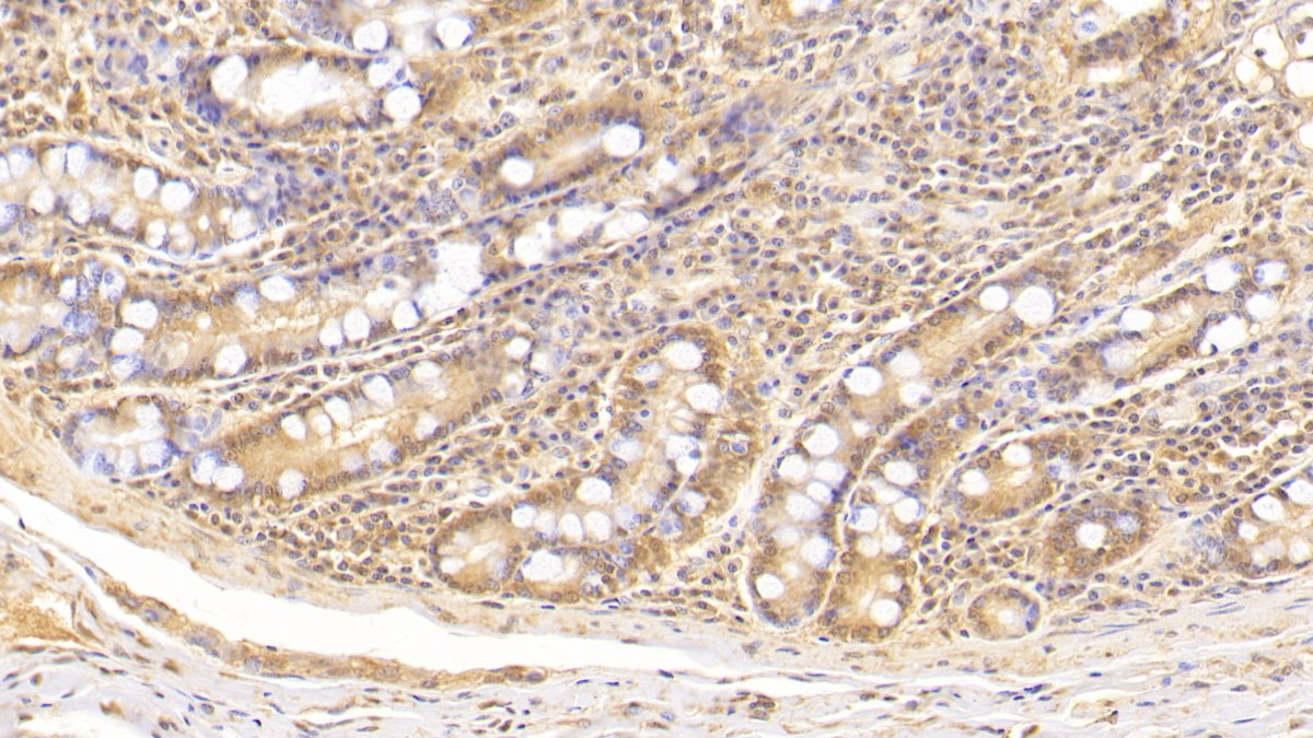 Monoclonal Antibody to Complement Component 5a (C5a)