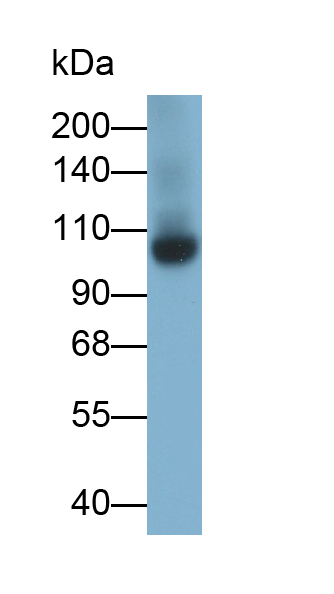 Monoclonal Antibody to Complement Component 5a (C5a)