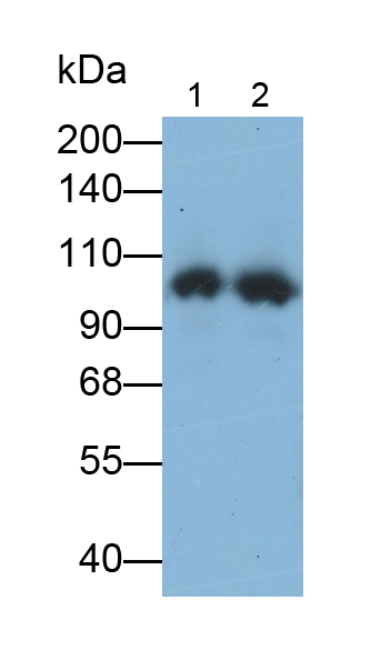 Monoclonal Antibody to Complement Component 5a (C5a)