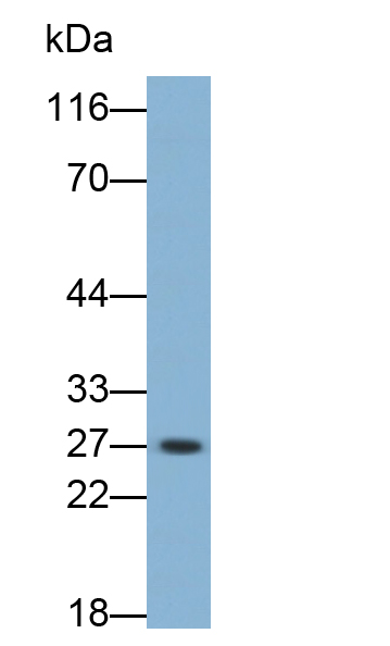 Monoclonal Antibody to Complement Component 5a (C5a)