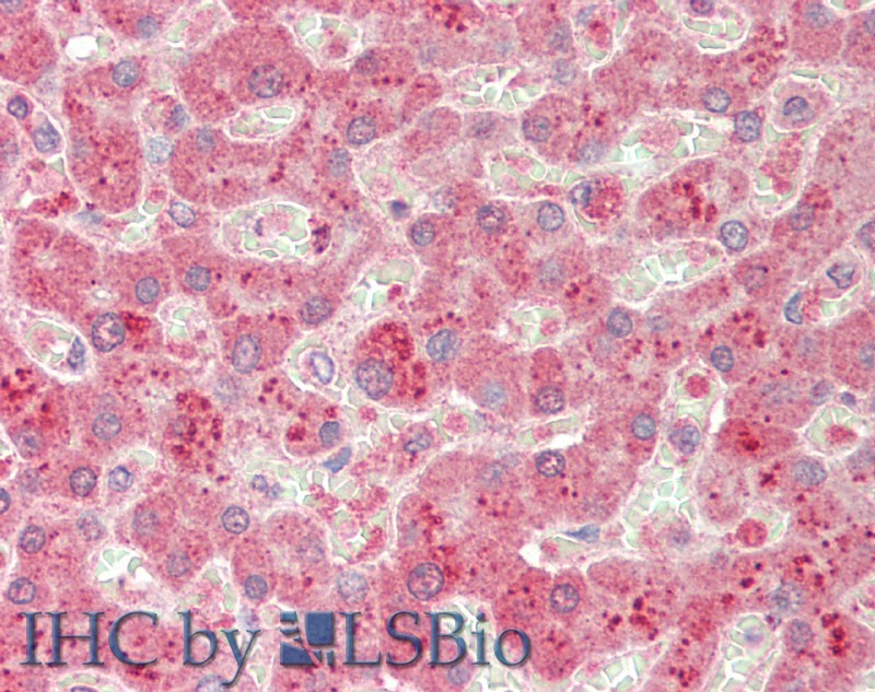 Monoclonal Antibody to Complement Component 5a (C5a)