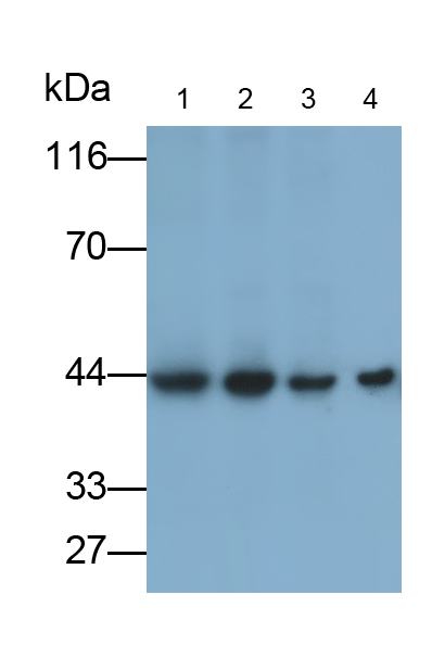 Monoclonal Antibody to Tissue Factor Pathway Inhibitor (TFPI)