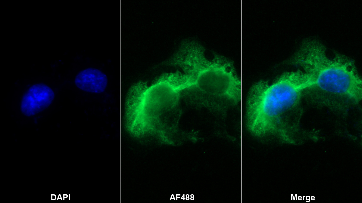 Monoclonal Antibody to Tissue Factor Pathway Inhibitor (TFPI)