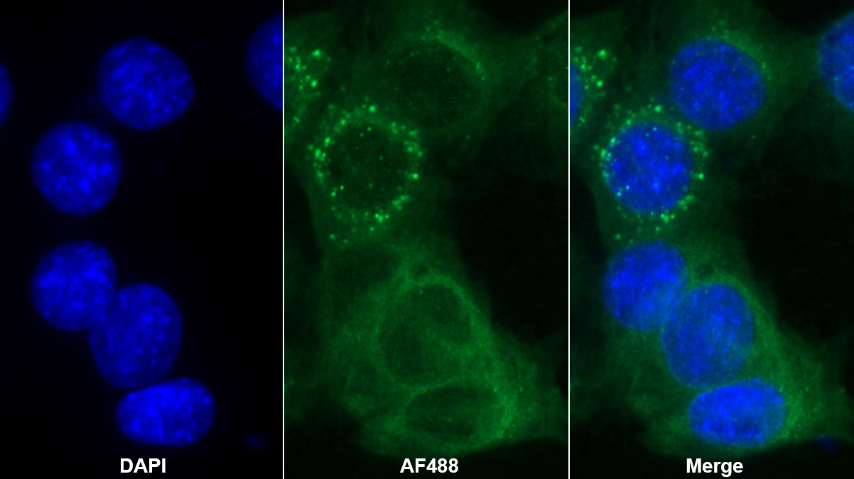 Monoclonal Antibody to Tissue Factor Pathway Inhibitor (TFPI)