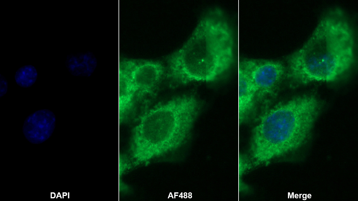 Monoclonal Antibody to Tissue Factor Pathway Inhibitor (TFPI)