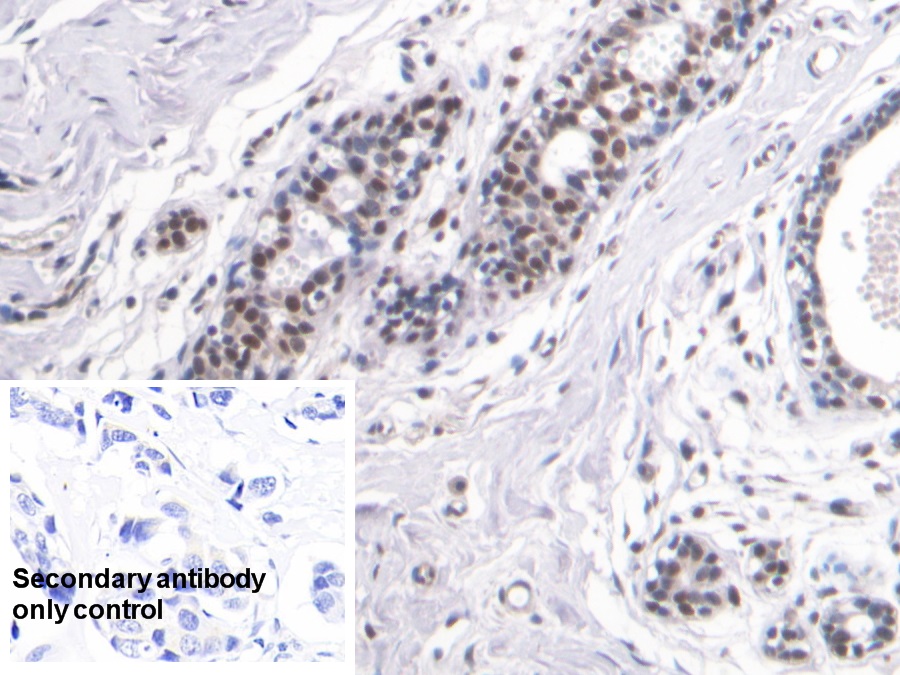 Monoclonal Antibody to High Mobility Group Protein 1 (HMGB1)