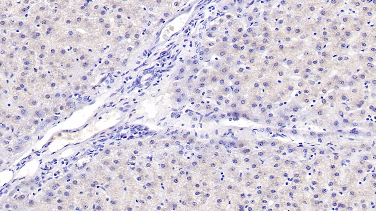 Monoclonal Antibody to Alpha-Hemoglobin Stabilizing Protein (aHSP)