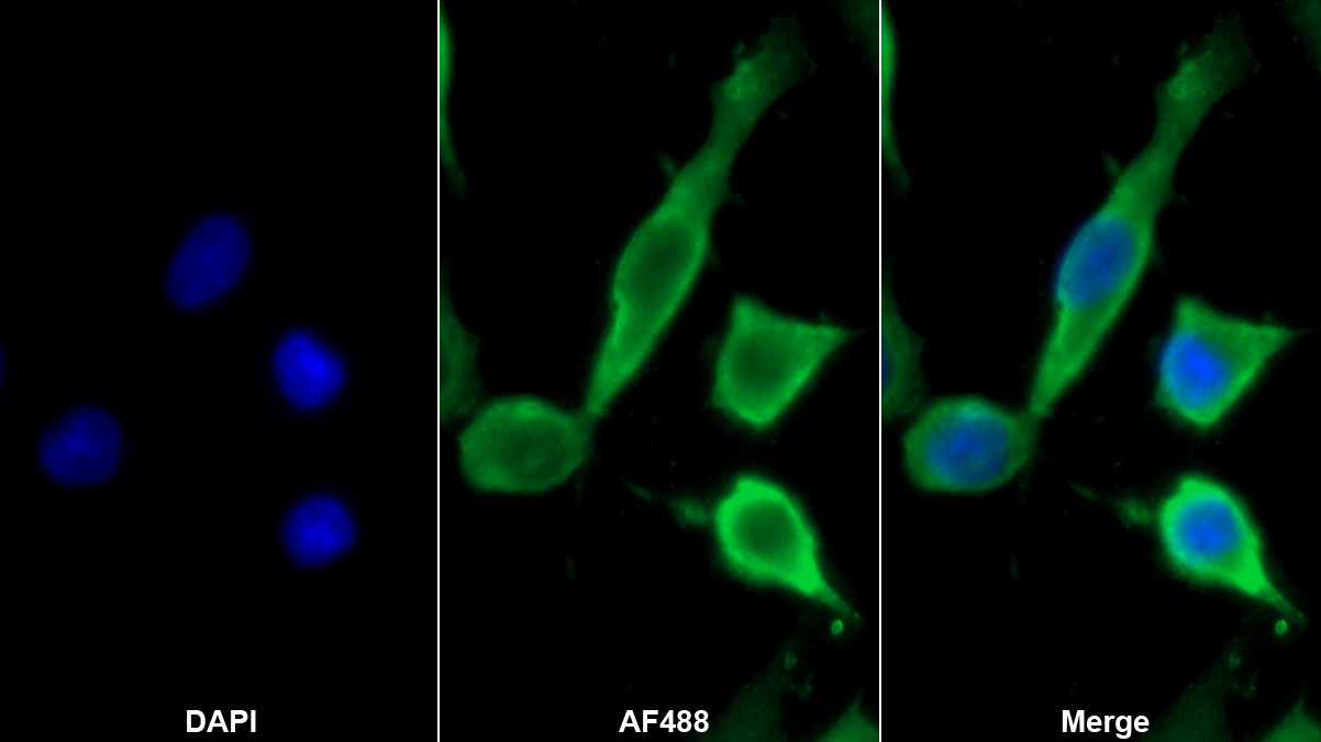 Monoclonal Antibody to Synaptophysin (SYP)