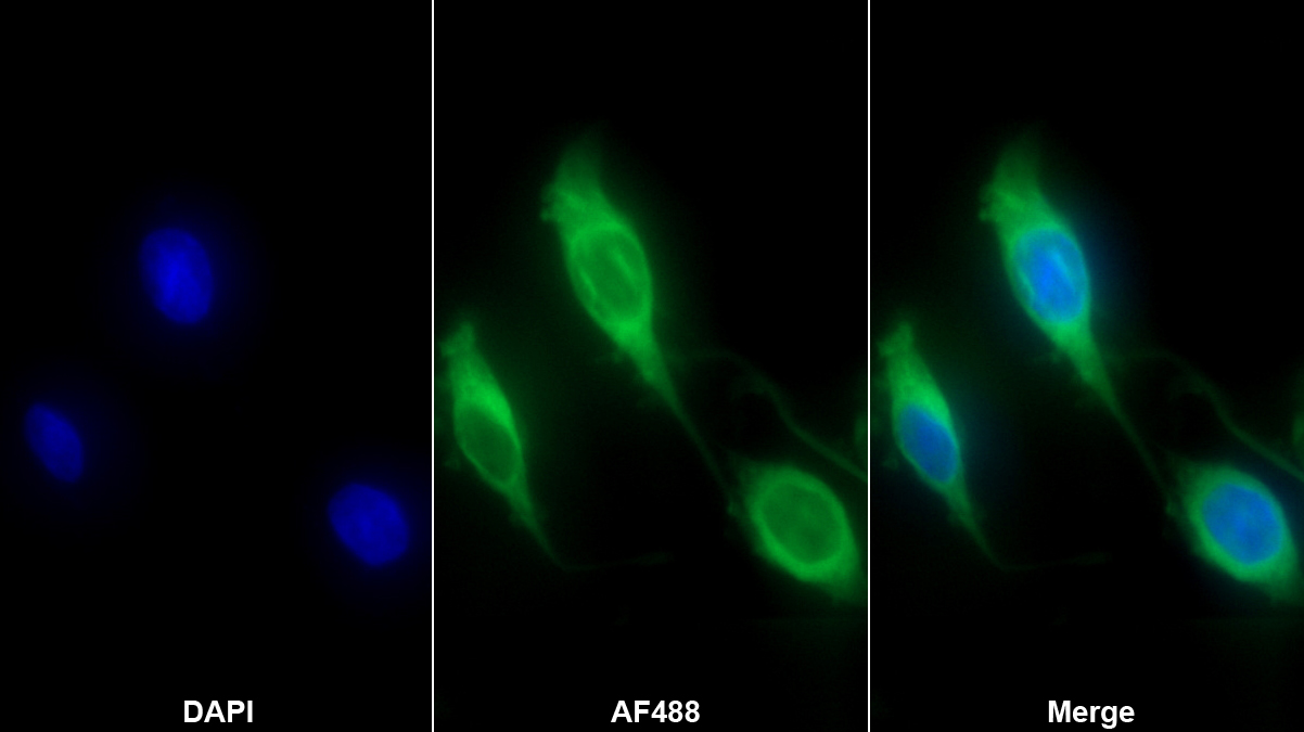 Monoclonal Antibody to Neurokinin A (NKA)