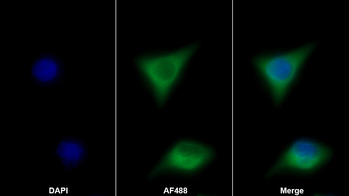 Monoclonal Antibody to Neurokinin A (NKA)