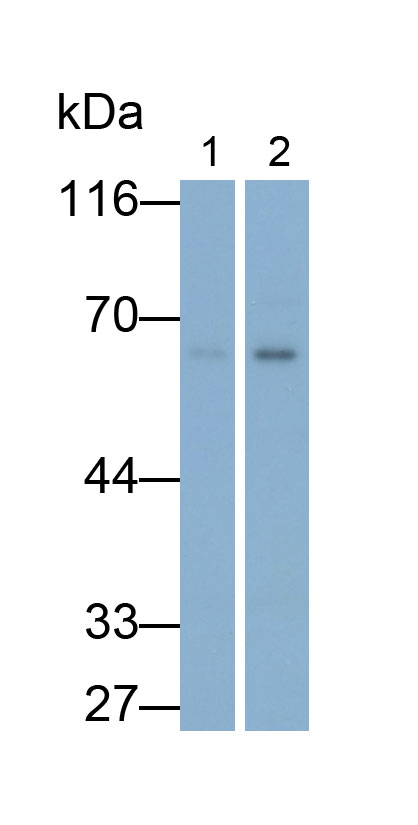 Monoclonal Antibody to Estrogen Receptor Beta (ERb)