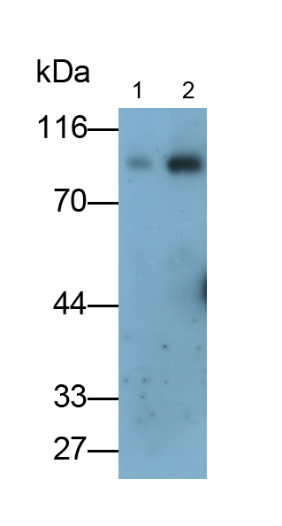 Monoclonal Antibody to Protein Kinase C Epsilon (PKCe)
