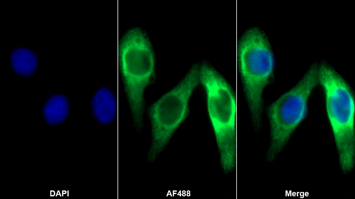 Monoclonal Antibody to Protein Kinase C Epsilon (PKCe)