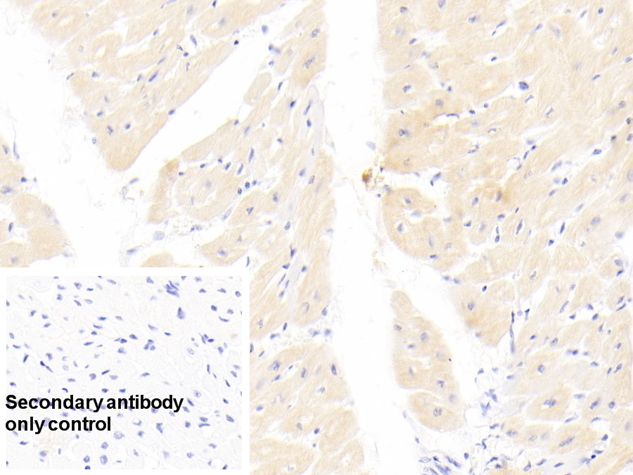 Monoclonal Antibody to Cardiac Troponin I (cTnI)