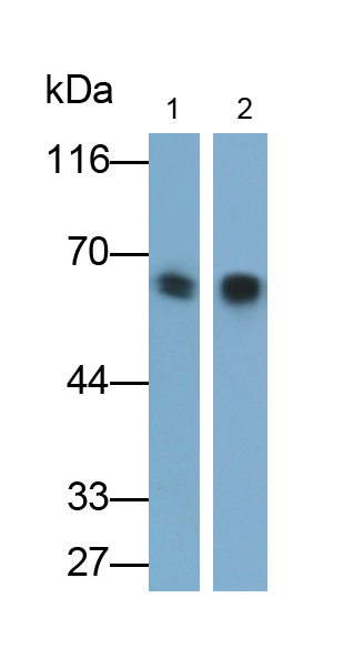 Monoclonal Antibody to Cytokeratin 5 (CK5)
