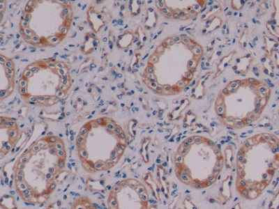 Monoclonal Antibody to Nestin (NES)