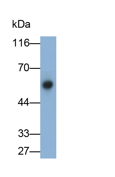 Monoclonal Antibody to Cytokeratin 15 (CK15)