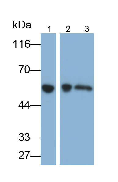 Monoclonal Antibody to Cytokeratin 15 (CK15)