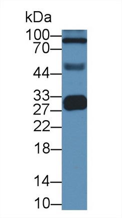 Monoclonal Antibody to Apolipoprotein A1 (APOA1)