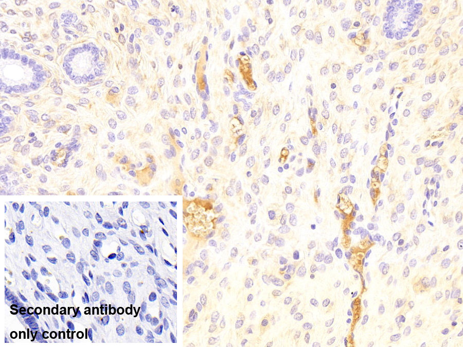 Monoclonal Antibody to Apolipoprotein A1 (APOA1)
