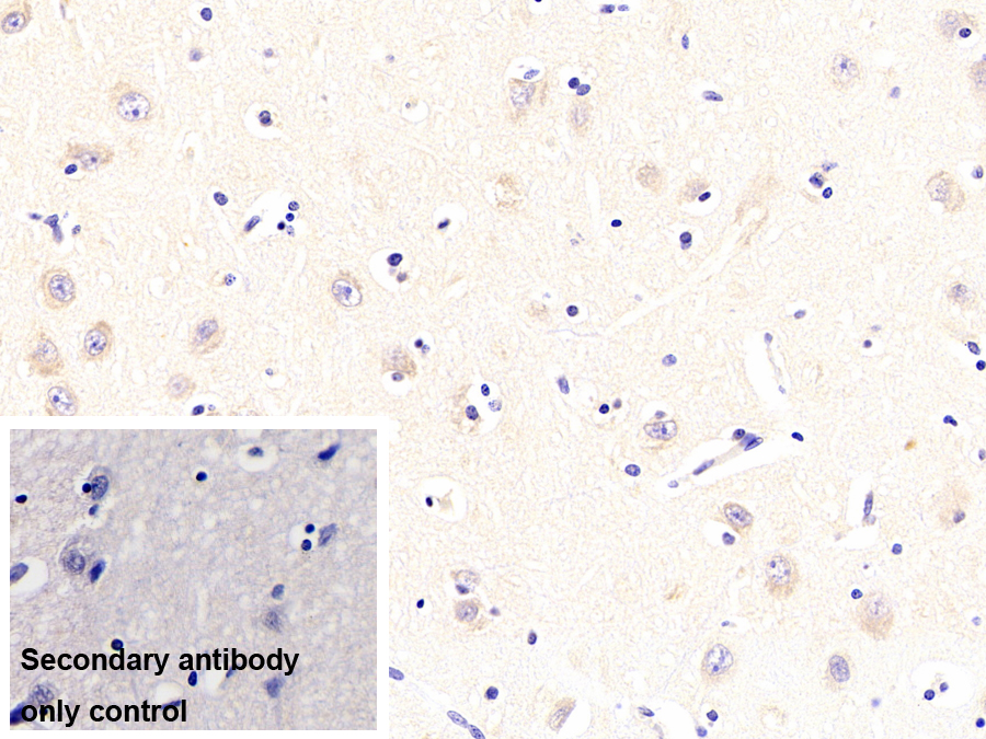 Monoclonal Antibody to Protein Kinase R (PKR)