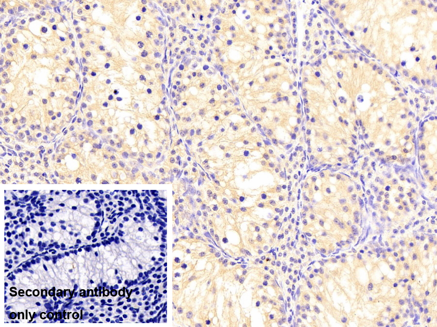 Monoclonal Antibody to Protein Kinase R (PKR)