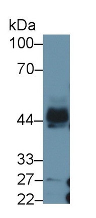 Monoclonal Antibody to Plasminogen Activator Inhibitor 1 (PAI1)