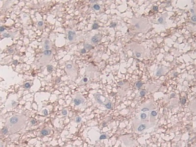 Monoclonal Antibody to Plasminogen Activator Inhibitor 1 (PAI1)