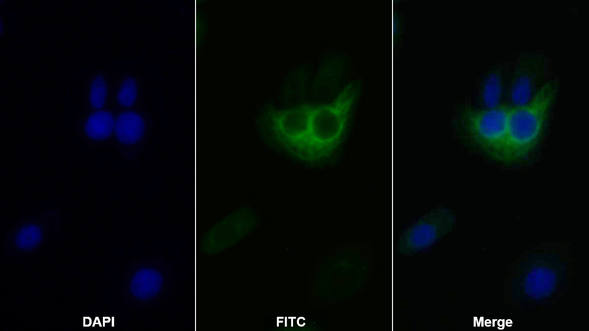 Monoclonal Antibody to Plasminogen Activator Inhibitor 1 (PAI1)