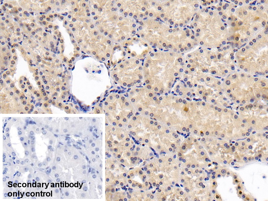 Monoclonal Antibody to Plasminogen Activator Inhibitor 1 (PAI1)