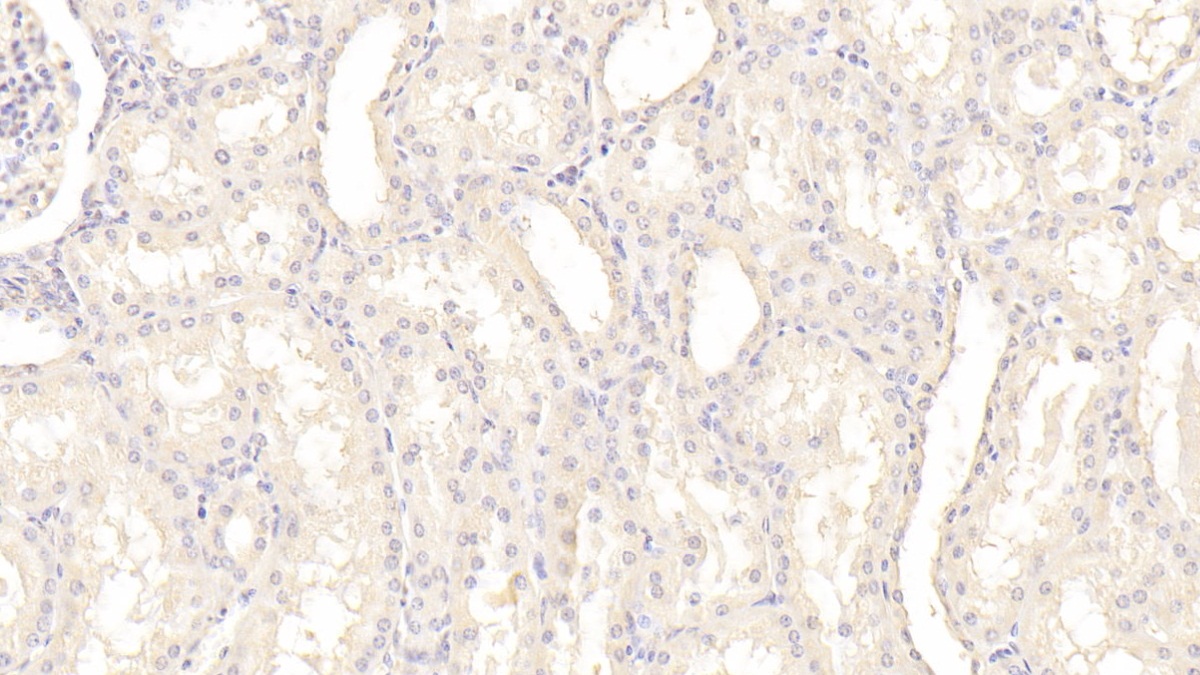 Monoclonal Antibody to Plasminogen Activator Inhibitor 1 (PAI1)