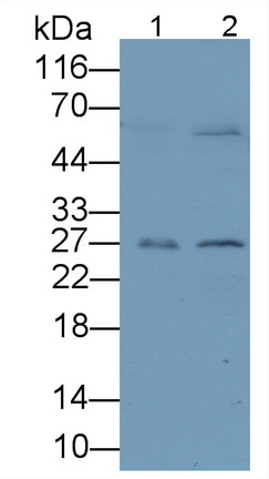 Monoclonal Antibody to Myelin Basic Protein (MBP)