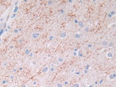 Monoclonal Antibody to Brain Natriuretic Peptide (BNP)