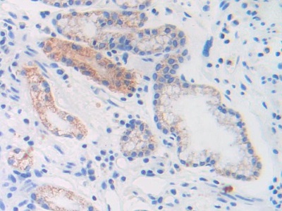 Monoclonal Antibody to Brain Natriuretic Peptide (BNP)