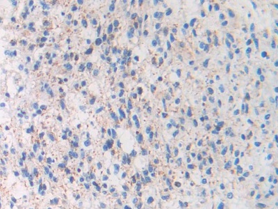 Monoclonal Antibody to Brain Natriuretic Peptide (BNP)