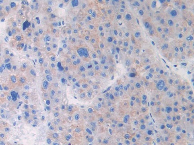 Monoclonal Antibody to Brain Natriuretic Peptide (BNP)