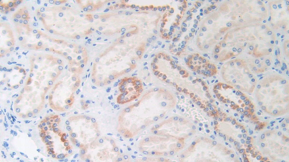 Monoclonal Antibody to Brain Natriuretic Peptide (BNP)