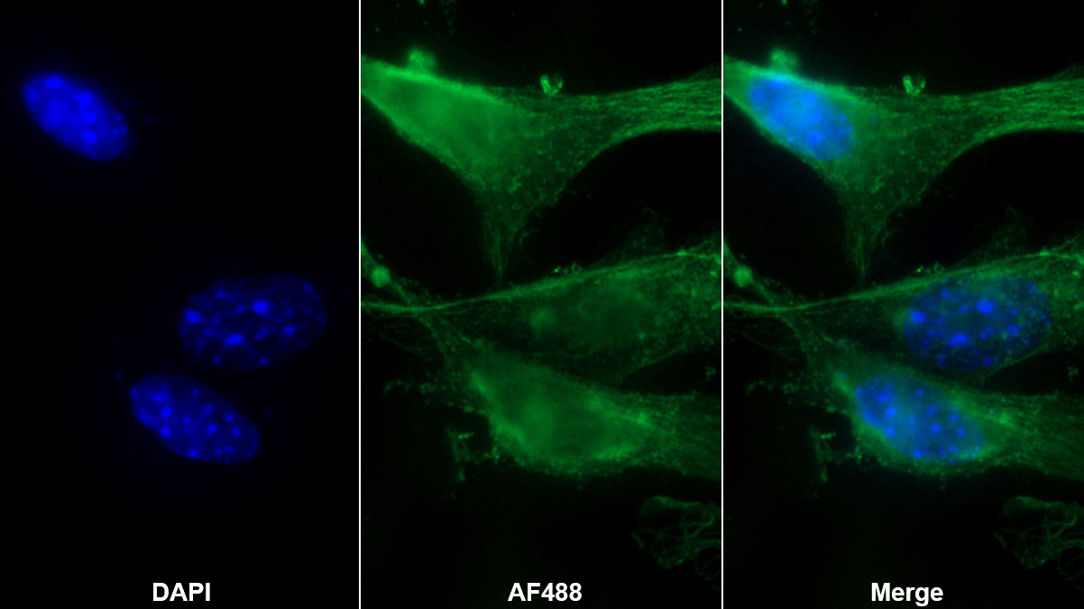 Monoclonal Antibody to Brain Natriuretic Peptide (BNP)