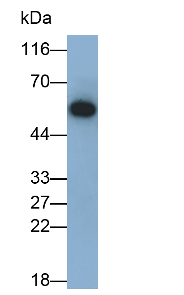 Monoclonal Antibody to Immunoglobulin G (IgG)